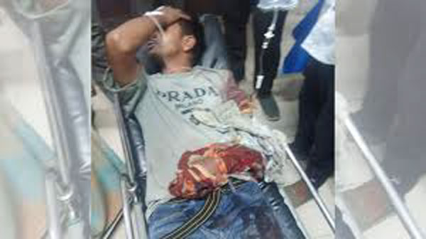 চট্টগ্রামে সন্ত্রাসীদের গুলিতে দুই অটোরিকশা চালক গুলিবিদ্ধ